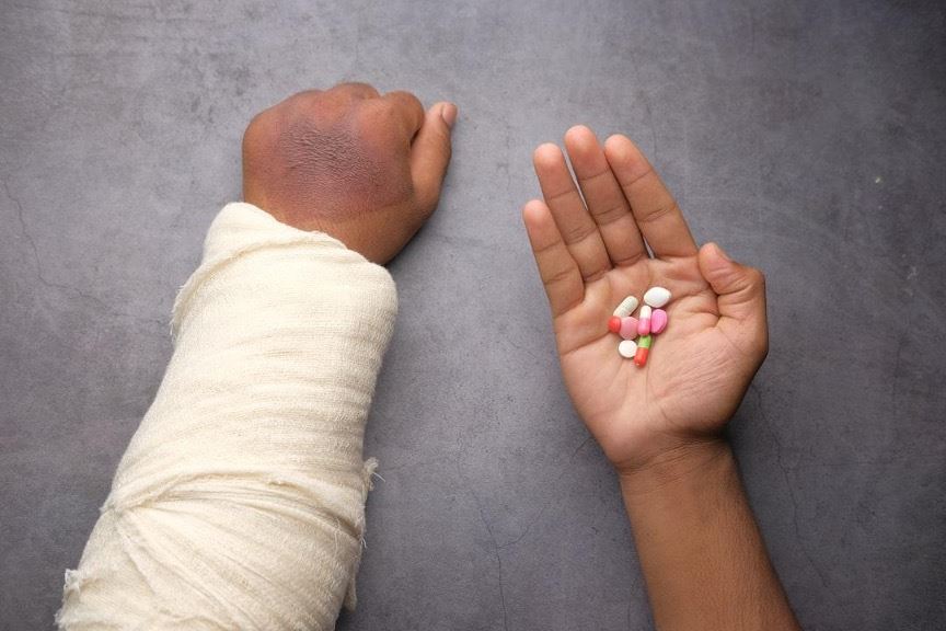 injured arm and hand holding pills