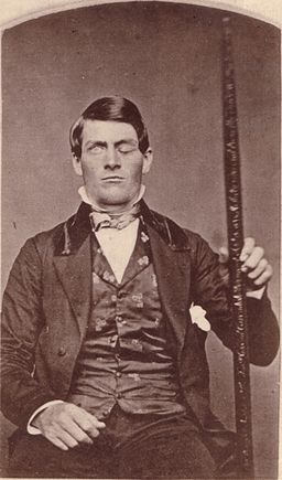Who is phineas gage_