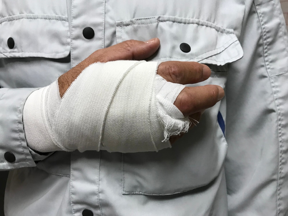 Male worker who injured his hand during work.