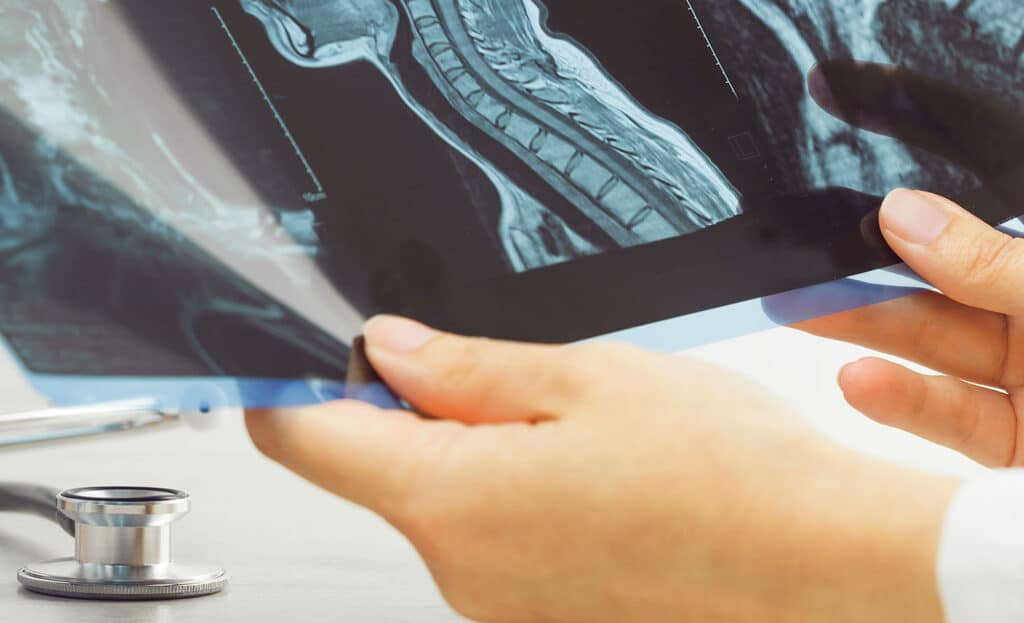 Female doctors hand pointing at x-ray or mri medical imaging with a head and neck condition.