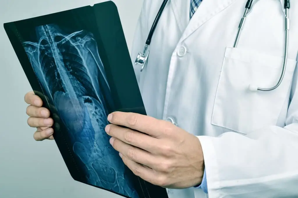 Closeup of a young caucasian doctor man observing a skeleton radiograph