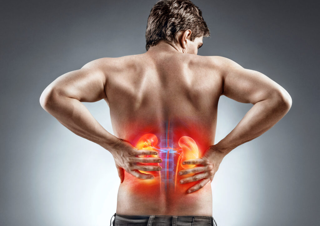 a graphic of a shirtless man's back with kidneys hghlighted in red