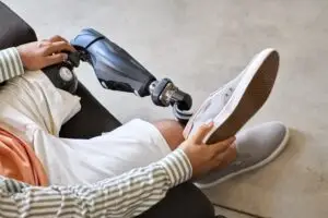 Man amputee with prosthetic leg