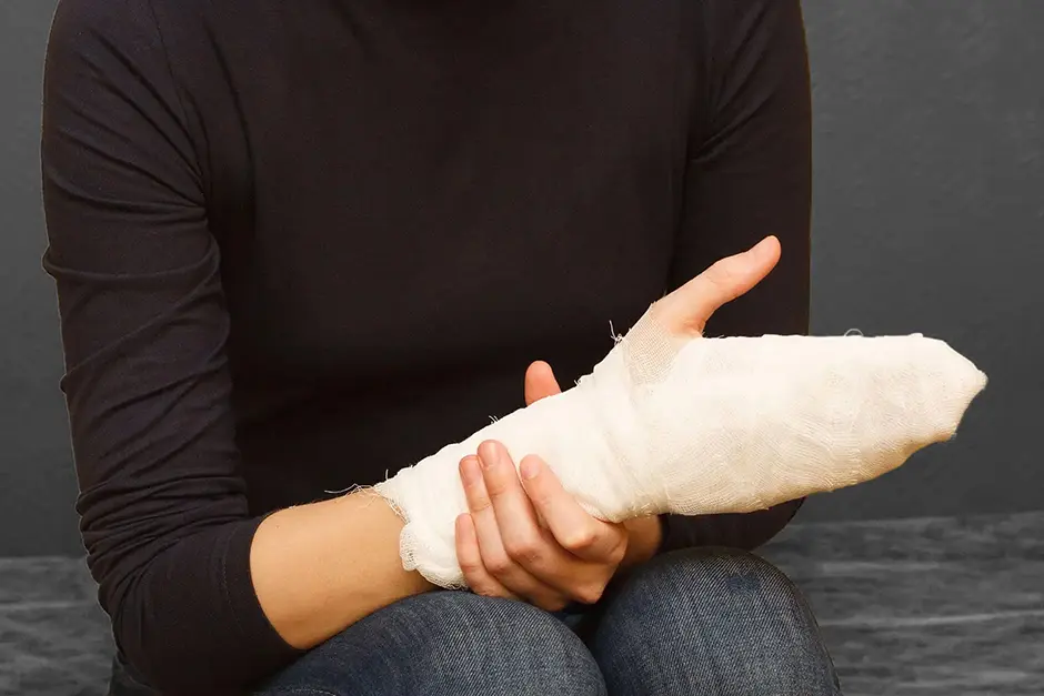 Hand and wrist injury first aid medical bandage during body burn of a young woman in the hospital