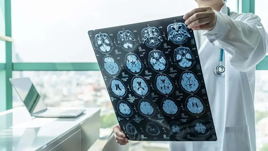 Brain disease diagnosis with medical doctor seeing magnetic resonance imaging (mri)