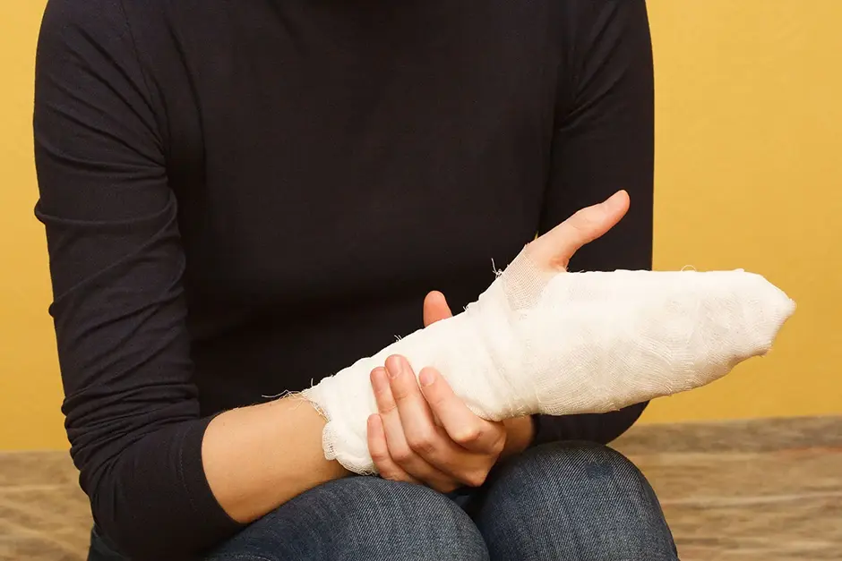 Hand and wrist injury first aid medical bandage during body burn of a young woman in the hospital